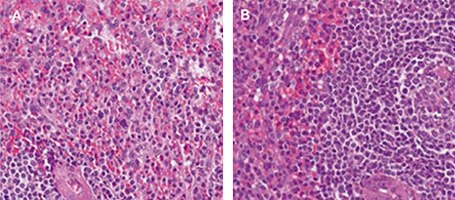 Micrographs of tonsil tissue stained with Hematoxylin and Eosin