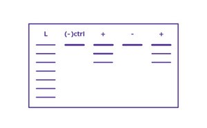 Agarose gel electrophoresis