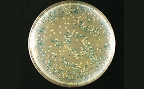 利用X-gal对重组细菌进行蓝白筛选。