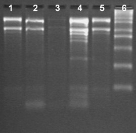 Total RNA Isolation from different tissues of Brinjal using the Spectrum™ Total RNA kit