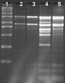 Total RNA Isolation from different tissue types of chilli using the Spectrum™ Total RNA kit