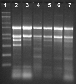 Total RNA Isolation from different tissue types of maize using the Spectrum™ Total RNA kit