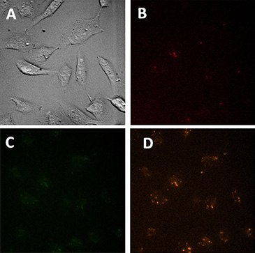 Microscopic images of control cells (treated only with transfection reagent).