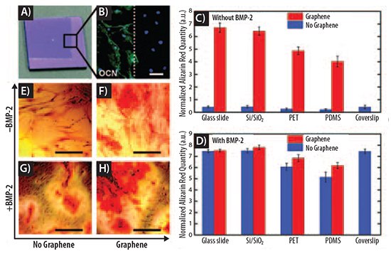 Graphene accelerates bone cell differentiation