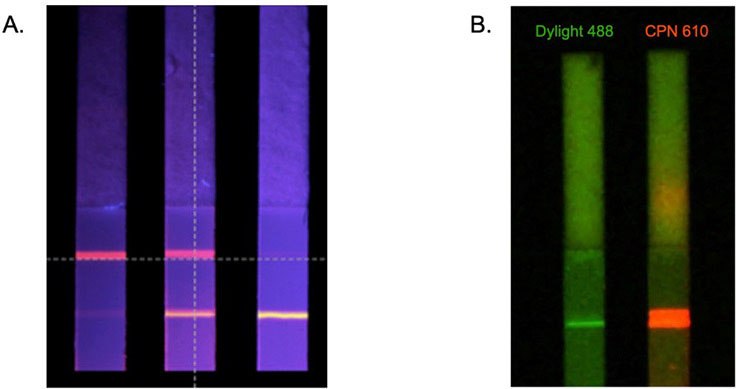 Multiplexed lateral flow detection strips