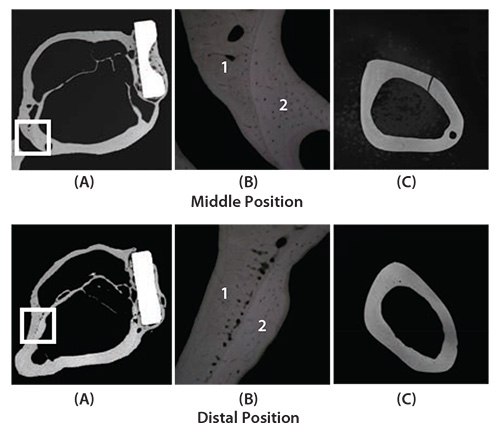 cross sections of fracture models implanted with and without bone plates made of TNTZ