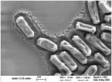在硅片上生长的产气荚膜梭菌的扫描电子显微照片（来源：S. Melville，弗吉尼亚理工大学生物科学系） 