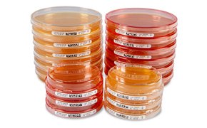 A close-up view of multiple petri dishes in various sizes, some stacked and others placed separately, all labeled, demonstrating a variety of cultured media in a laboratory setting.