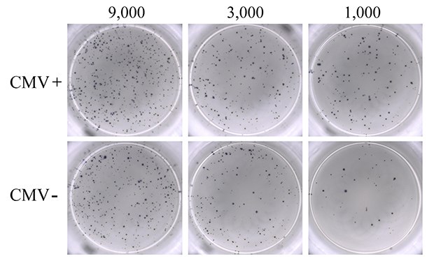 ELISpot assay using 0.3 µM ionomycin + 0.2 µM PMA to stimulate IFN-γ secretion from PBMCs. 