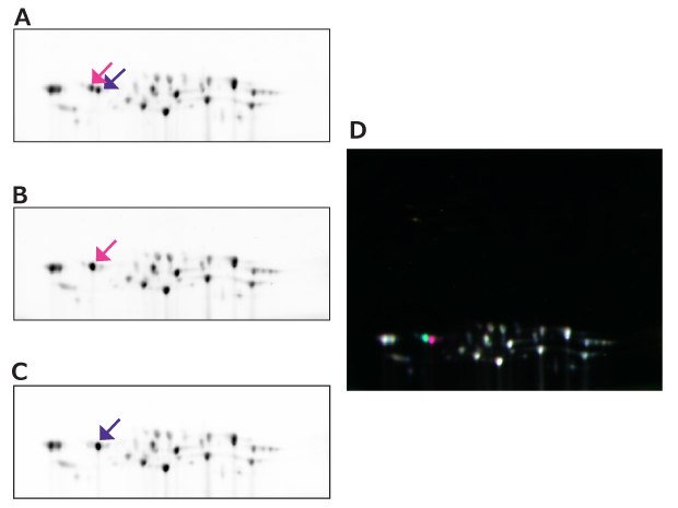 2D-DIGE Between 20S Proteasome Samples Purified Under Different Conditions Left side shows various 2D-DIGE images of the 20S proteasome samples for Cy2 labeled 20S proteasome 1, Cy3 labeled 20S proteasome 2, Cy5 labeled 20S proteasome 3 from top to bottom showing different phosphorylation states of these subunits. The right side is a merged image of the subunits.