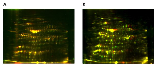 Differential Fluorescence Analysis of Plant Protein Extraction Methods 2D-E images of leaf protein extracts using the Auto2D® automated gel electrophoresis system. Left image shows fluorescent image using combination of protein extraction kit and rehydration solution while right image shows differential image of protein extract using a protease inhibitor cocktail. Image is similar across both methods.