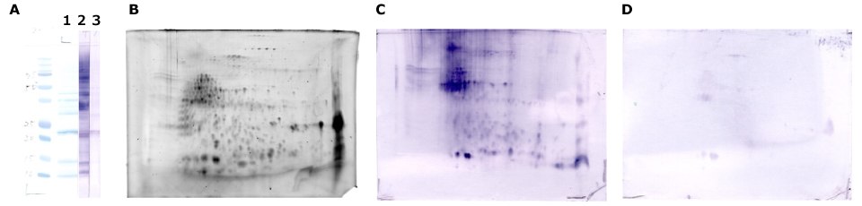 The Auto2D system for buckwheat-allergic patient serum separation and immunodetection.