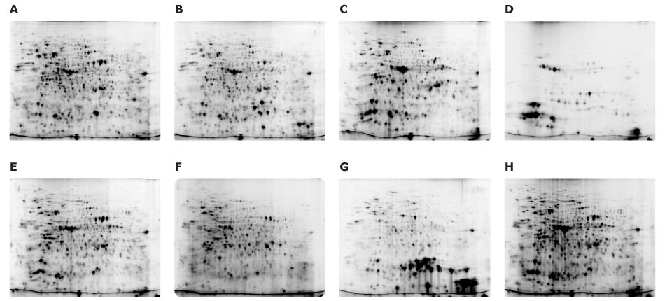 Organ-Specific Proteomes of Arabidopsis thaliana Fluorescence-labeled 2D-E images of plant organ samples using the Auto2D® automated gel electrophoresis system. Images include flower, seed pod, leaf, chloroplast, stem, root, seed, and whole plant. Each sample has a clear and differentiated profile.