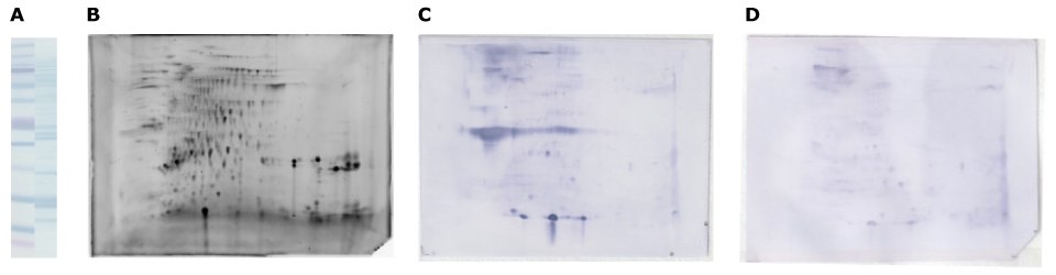 The Auto2D system for walnut allergy patient serum separation and immunodetection