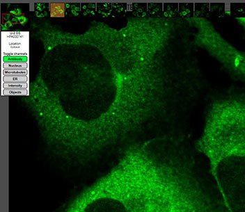 Anti-CCNB1 (cyclin B1) Immunofluorescence image with antibody staining.