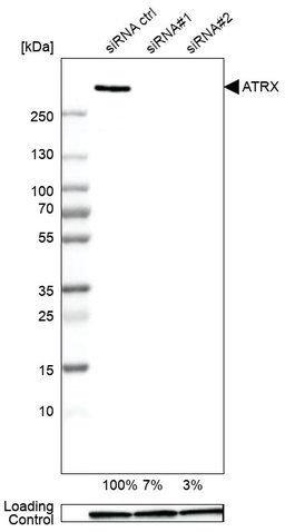 Genetic validation