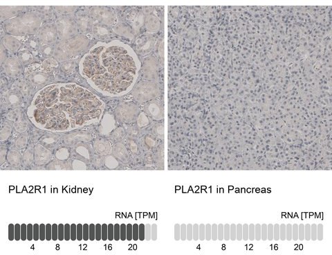 hpa012657-ihc-n