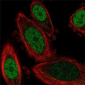 Immunofluorescent staining showing nuclear localization of transcription factor