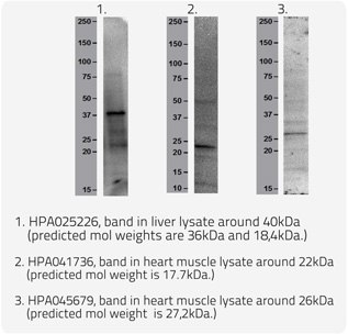 Proteins with Lipofuscin 