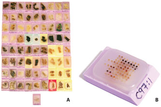 Tissue Microarray