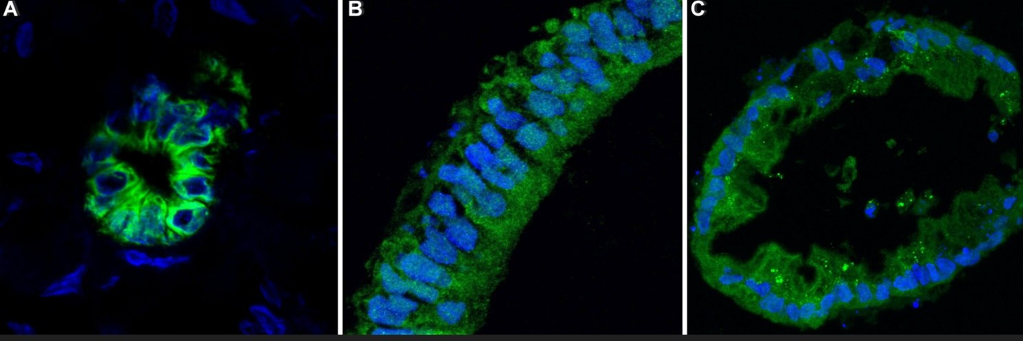 In image A, a small, thick ring representing the staining from Anti-Keratin 7 is in the center of the image with scatter nuclei around it. In image B, a thick line bisects the image, filled with Anti-Keratin staining and nuclei. In image C, a think ring representing the staining from Anti-Keratin fills the image, with a thin ring inside that represents the nuclei.