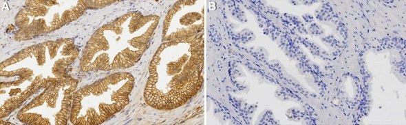 In image A, large ovals cover the image, the outside stained with the ZooMAb® antibody and representing the membrane staining. In image B, small ovals are scattered over the image, but the large ovals are not visible.