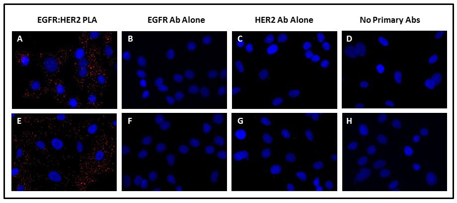 Duolink® PLA检测EGF诱导的EGFR:HER2二聚化。