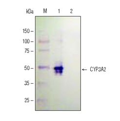 Extract preparation and Western Analysis