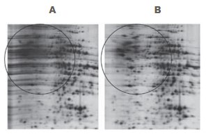 2-D Clean-Up Kit eliminates most of the horizontal streaking caused by residual SDS