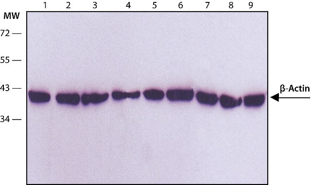 Western blot validation