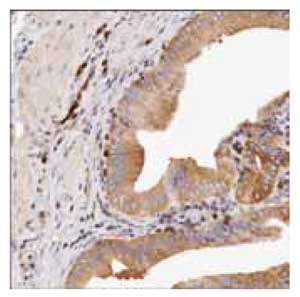 Immunoperoxidase staining of formalin-fixed