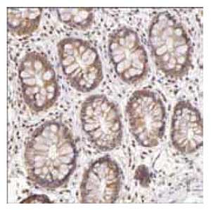 Immunoperoxidase staining of formalin-fixed