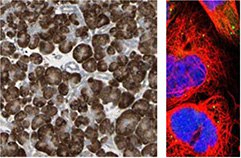 人-胰腺-组织-的-ihc-染色