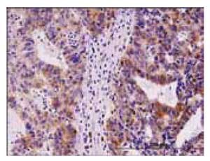 1.5 μg/mL using human stomach carcinoma tissue