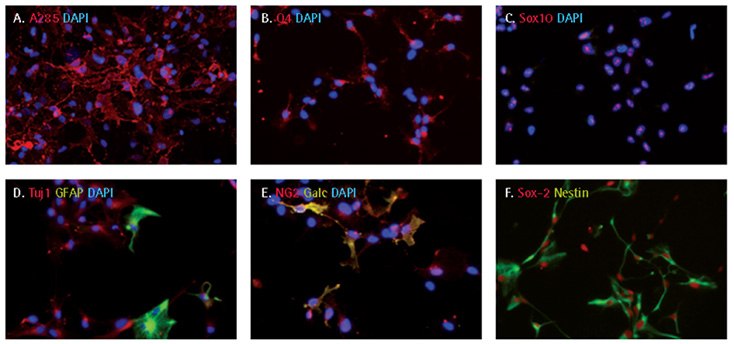 Oligodendrocyte differentiation of iPS cell derived NPCs