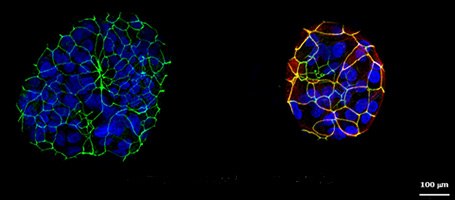 Generation of apical-out gastric organoids