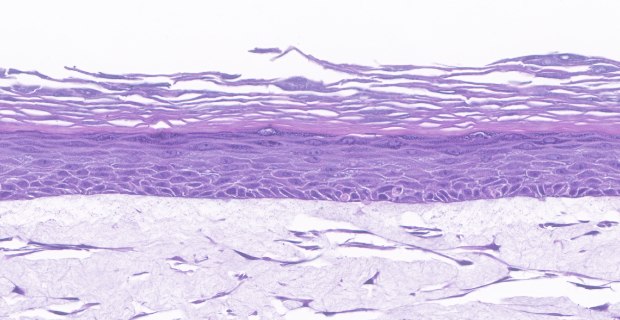 In vitro organotypic skin culture model