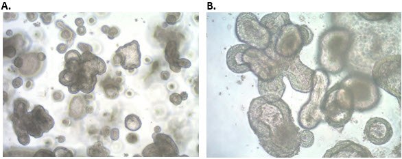 人iPS细胞来源结肠类器官的形态。成熟的人结肠类器官三维培养后呈现复杂形态。A) 4倍放大 B) 10倍放大。