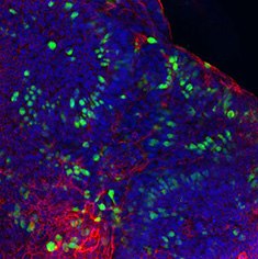 Fluorescence image of human colon organoids stained for mucin-1, F-actin, and DAPI