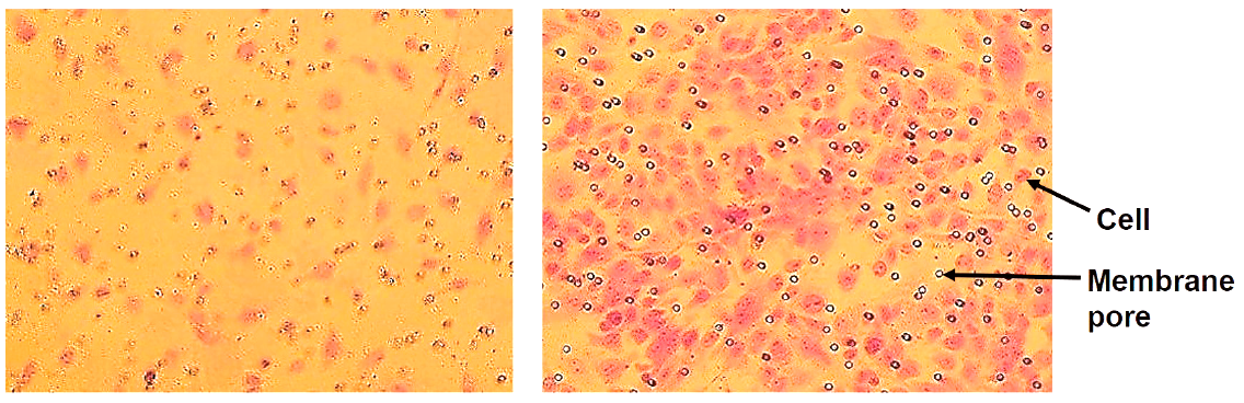 In vitro cell migration of endothelial cells stimulated by VEGF.