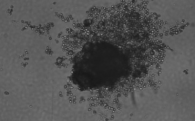 Microscopy image of hepatocytes forming spheroids after 3 days. Dark grey rectangle with light grey dots at the top right indicating cells. Large black circle in the center of the image indicating a forming spheroid.