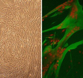 Human Skeletal Muscle Cells (HSkMC)