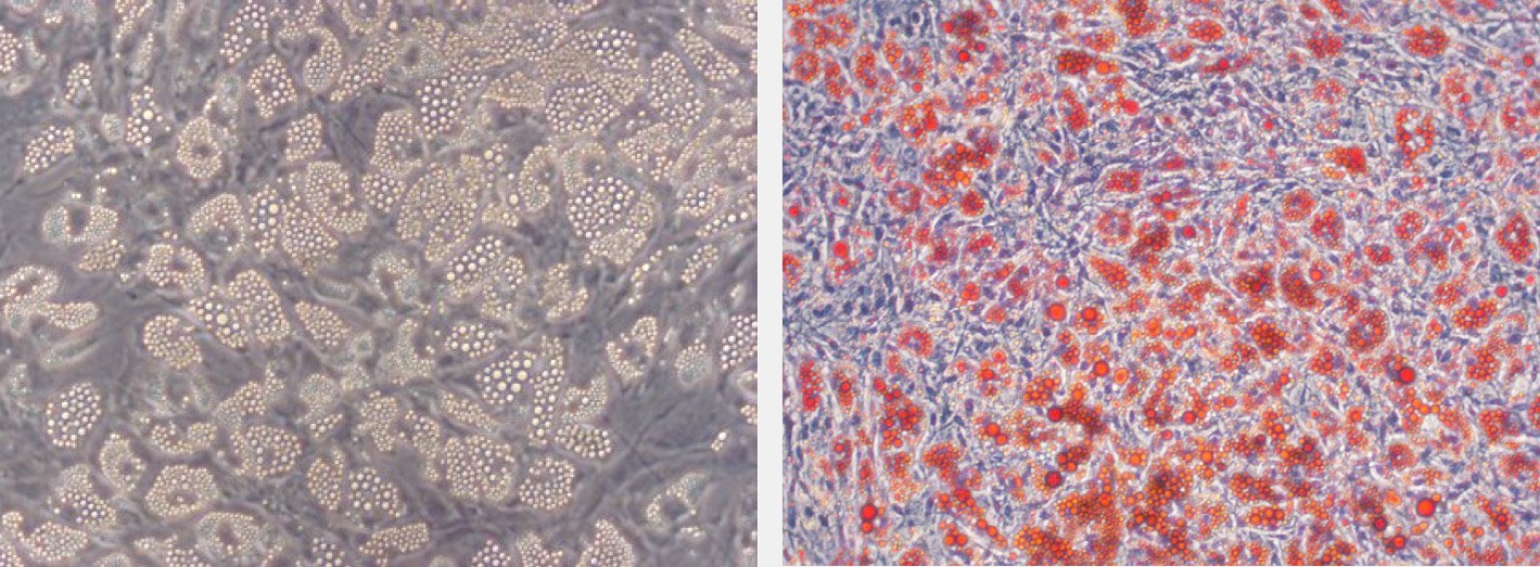 Oil Red O staining of lipid droplets in hMSC-BM derived adipocytes.