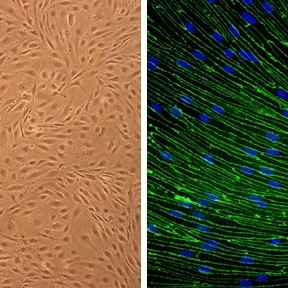 Rat Brain Microvascular Endothelial Cells (RBMVEC)