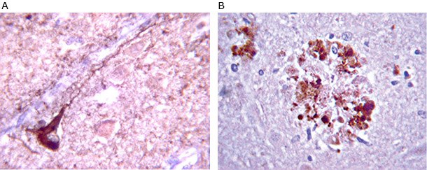 Anti-β-Amyloid antibody staining