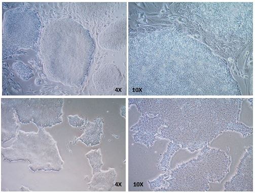 EZ-LiFT™ reagent removes feeders from human iPSC cocultures.