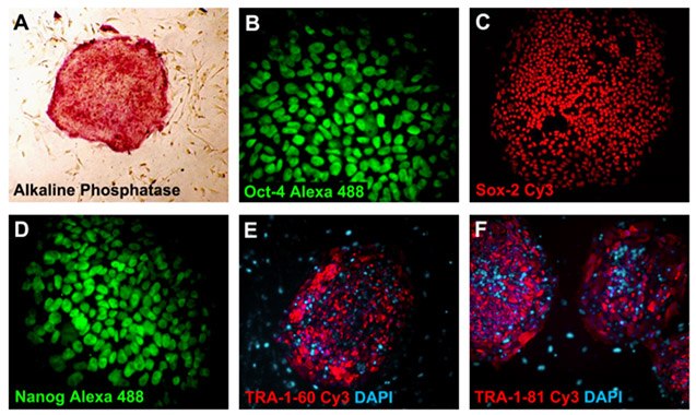 Pluripotent iPS cells express pluripotency markers.