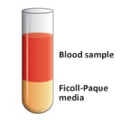 将血液样品铺在Ficoll-Paque培养基上