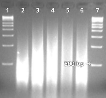 Whole Genome Amplification Performed on a Soil Sample