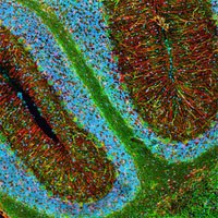 Fluorescent microscopy detection of non-phosphorylated rat neurofilament H (Cat. No. NE1023, green) by fluorescent staining of frozen sections of rat brain. Blue, Hoechst 33342.